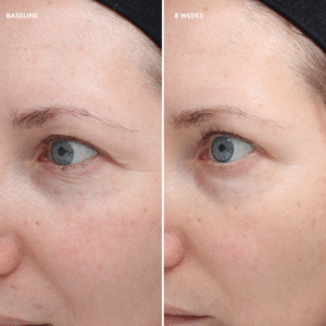 Total Eye® Firm &amp; Repair Cream