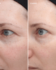 Total Eye® Firm & Repair Cream